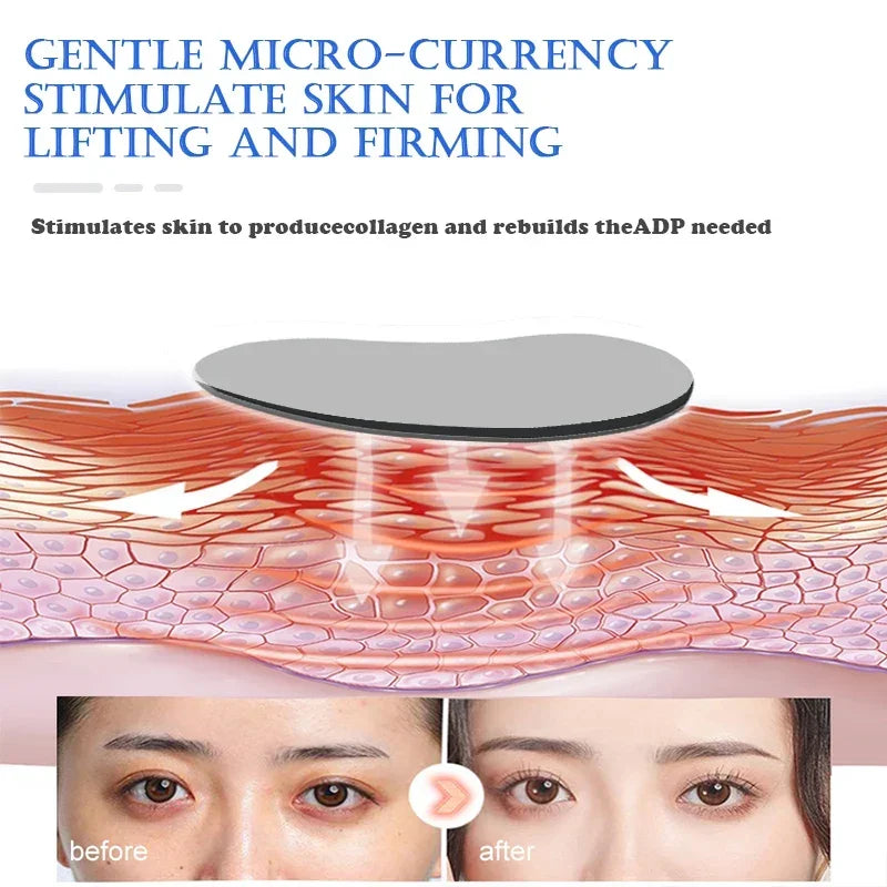 EMS Eye Lifting Device