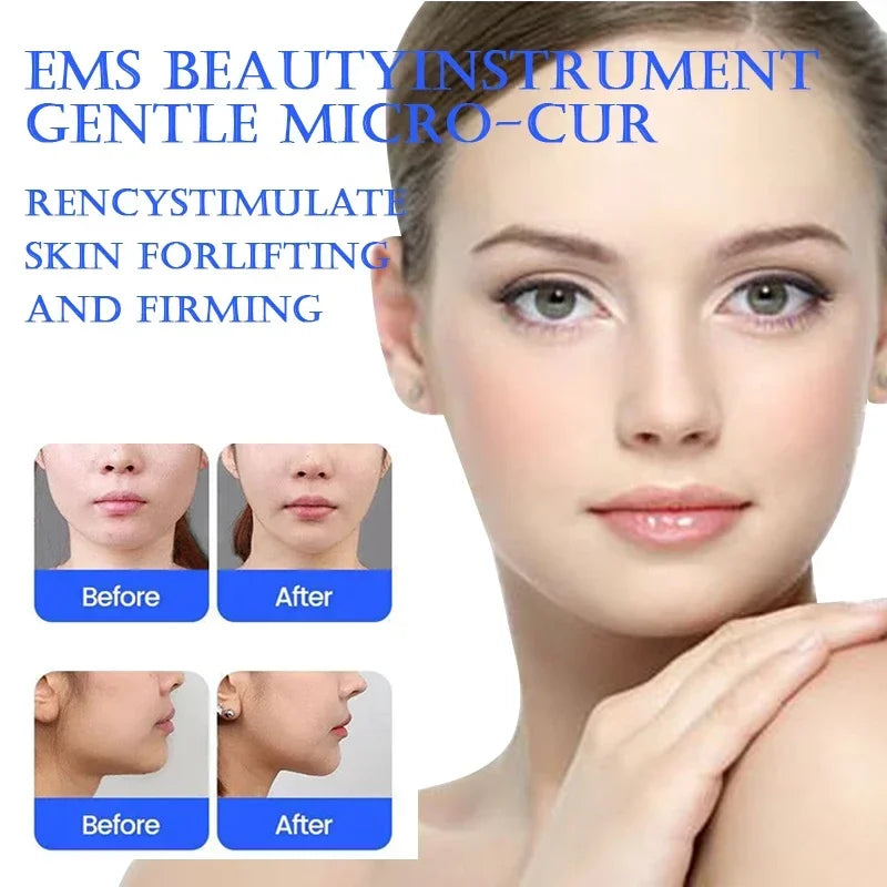 EMS Eye Lifting Device